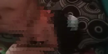 Warga Keranggan Tangerang Selatan Dibacok Begal Motor Pakai Celurit, Motor Scoopy Raib