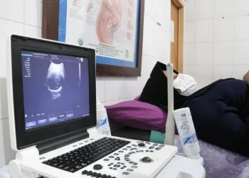 Hore, Pelayanan USG Pada Ibu Hamil di Seluruh Puskesmas Kota Tangerang Gratis