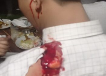 Lagi Hadiri Resepsi Pernikahan, Pria di Kranggan Tangsel Dibacok Sekelompok Pria Misterius
