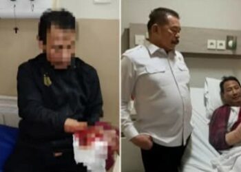Anggota Kejagung Dibacok OTK, Jari Putus! Ada Apa di Balik Serangan Brutal Ini?