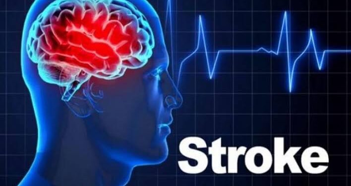 Stroke
