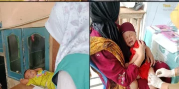 Warga Apresiasi Program ORI Campak Serentak di Tangsel, Kesadaran Kesehatan dan Partisipasi Meningkat