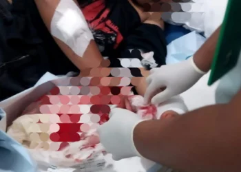 Dua Kelompok Remaja Terlibat Tawuran di Jembatan Kranggan - Suradita, Satu Orang Luka Serius, Pergelangan Tangan Sobek