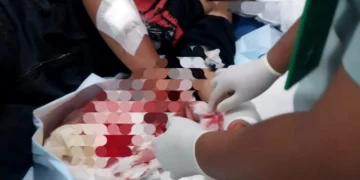 Dua Kelompok Remaja Terlibat Tawuran di Jembatan Kranggan - Suradita, Satu Orang Luka Serius, Pergelangan Tangan Sobek